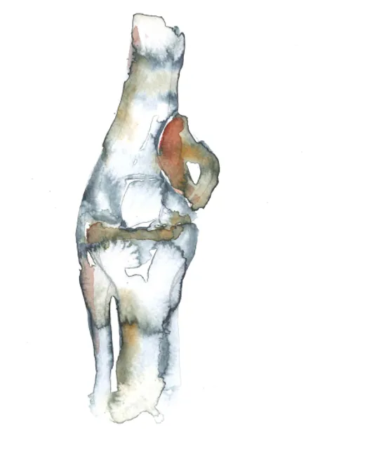 Akvarell som viser kne med beinkreft.