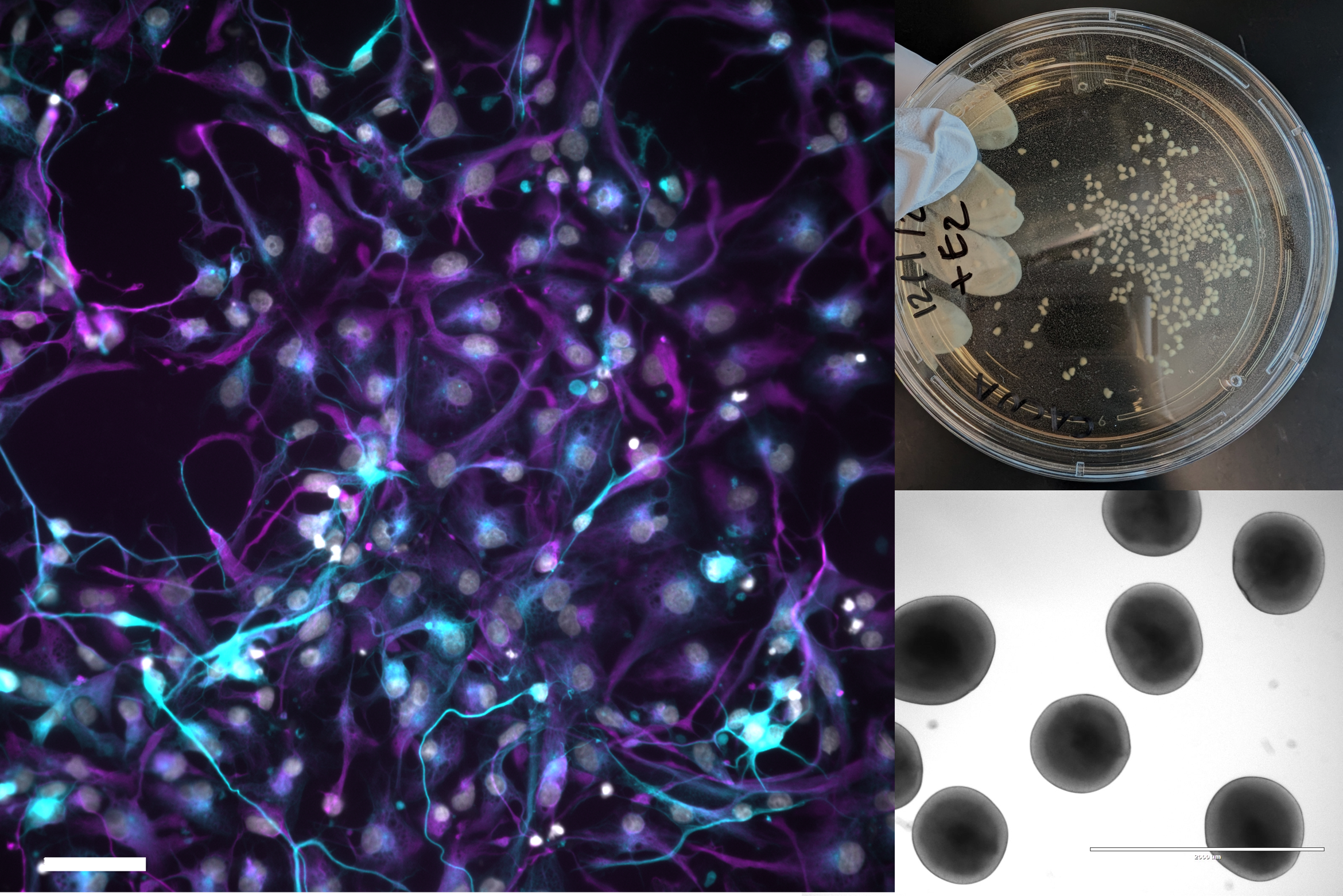 Brain organoids