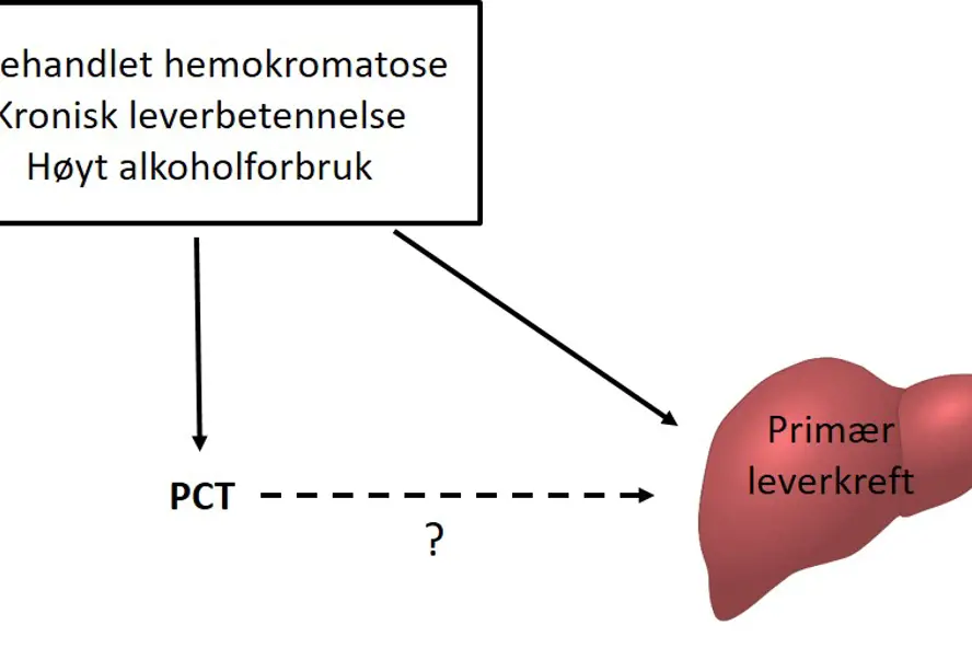 Illustrasjon av sammenhengen mellom utløsende faktorer, PCT og leverkreft