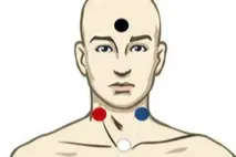 Tegning av person med prikker i ulike farger som markerer hvor elektrodene festes i pannen, og halsen. Illustrasjon