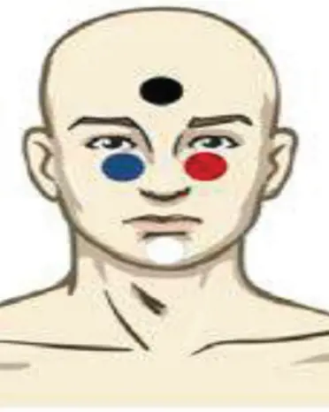 Tegning av person med fire prikker i ulik farge plassert i pannen, på hver side av nesen og på haken. Illustrasjon