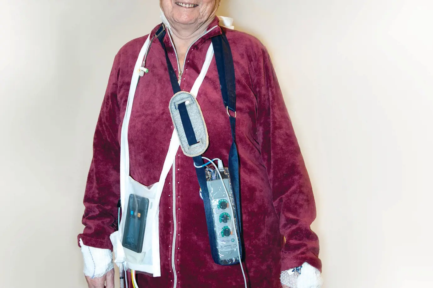 Bilde viser ein pasient som er oppe å går med mellombels pacemaker og telemetriovervaking.foto
