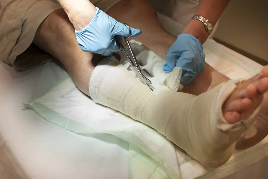 Helsepersonell klipper av gips på pasient. Foto