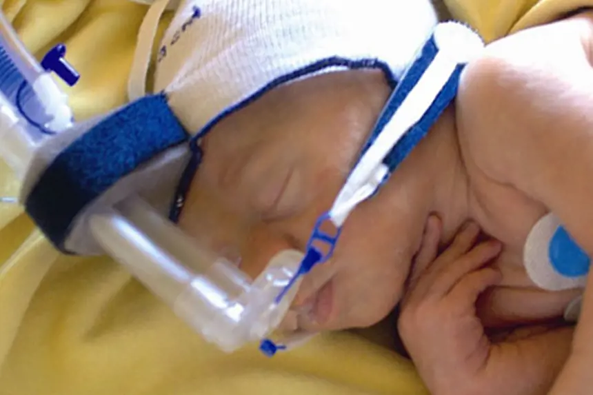 foto av nyfødt med pustehjelp