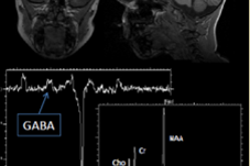 Bildediagnostikk hjerne.