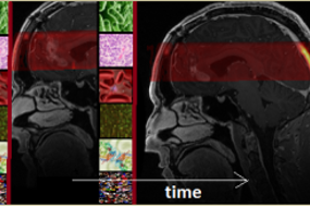 Bildediagnostikk hjerne