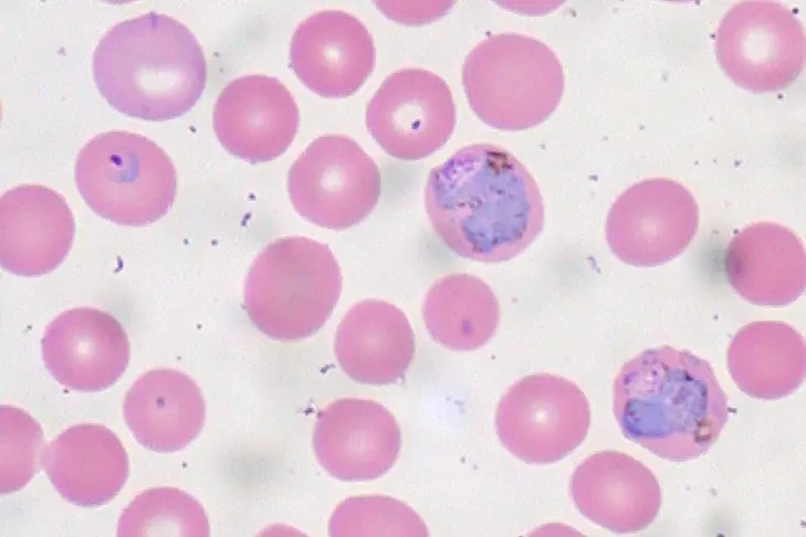 Bilde av malaria-parasitter