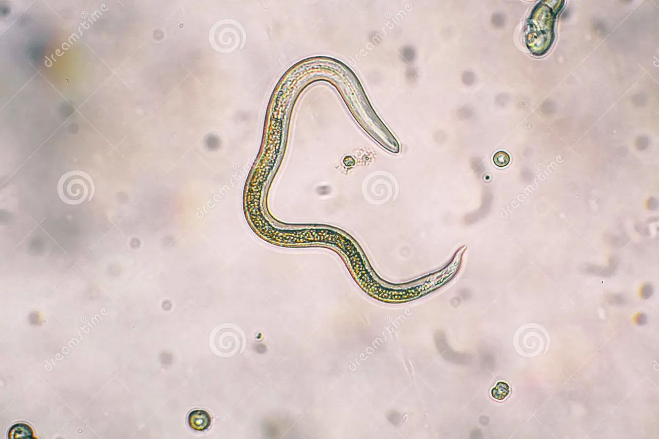INTESTINAL WORMS. mikroskop bilde
