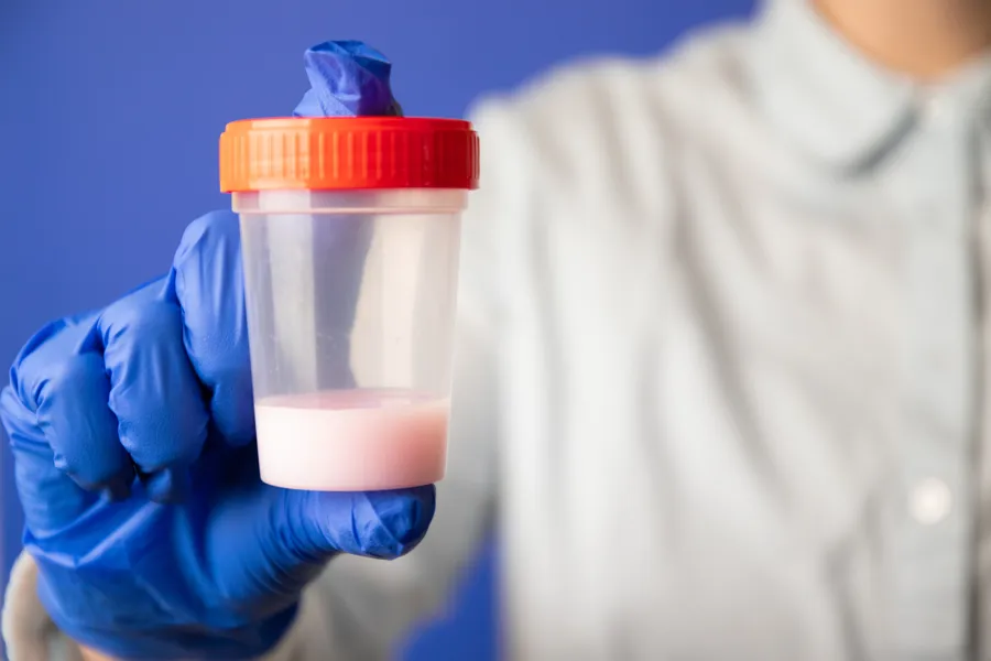 Hand with glove holding a semen sample in test glass. Photo