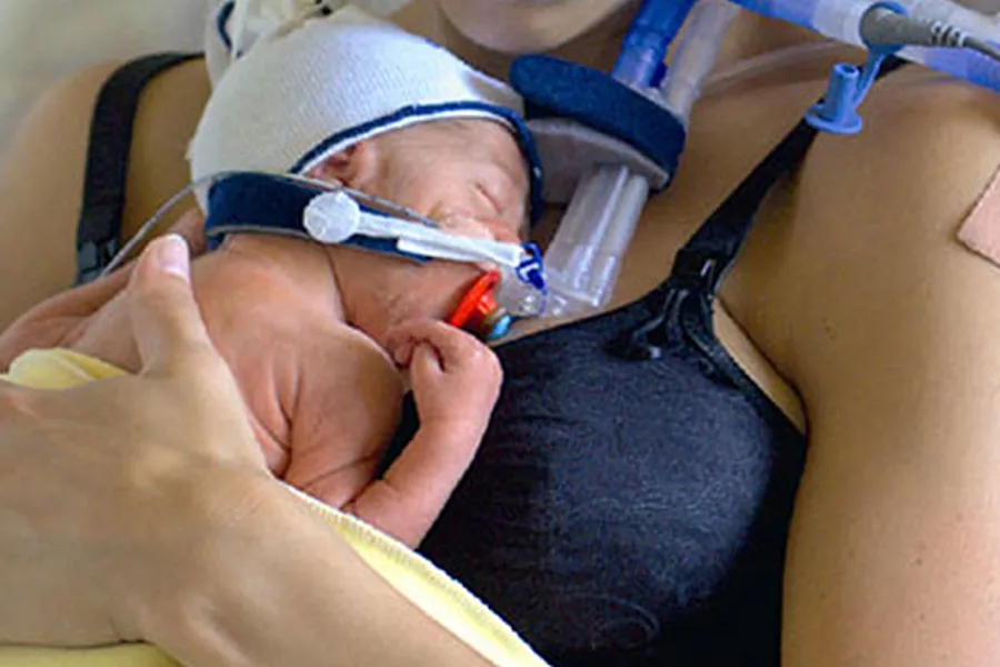 En prematur baby med maske ligger på brystet til en person