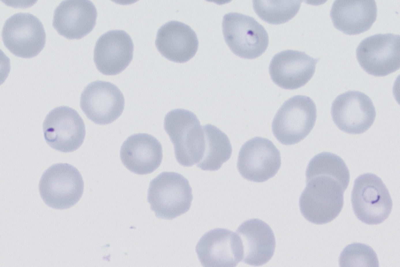 Pfalciparum.png